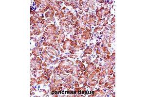 Immunohistochemistry (IHC) image for anti-Matrix Metallopeptidase 28 (MMP28) antibody (ABIN2997500) (MMP28 Antikörper)