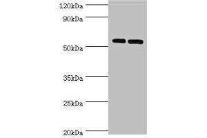 Western blot All lanes: PNPLA2 antibody at 10 μg/mL Lane 1: A431 whole cell lysate Lane 2: Hela whole cell lysate Secondary Goat polyclonal to rabbit IgG at 1/10000 dilution Predicted band size: 56, 20 kDa Observed band size: 56 kDa (PNPLA2 Antikörper  (AA 265-504))