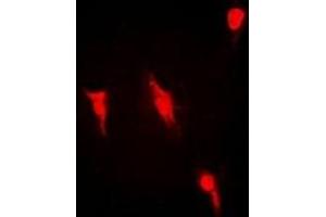 Immunofluorescent analysis of PRMT2 staining in Hela cells. (PRMT2 Antikörper)