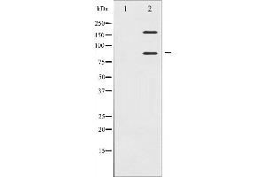Western blot analysis of IGF1R expression in Insulin treated 293 whole cell lysates,The lane on the left is treated with the antigen-specific peptide.