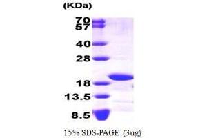 Figure annotation denotes ug of protein loaded and % gel used. (NADH Dehydrogenase (Ubiquinone) Fe-S Protein 4, 18kDa (NADH-Coenzyme Q Reductase) (NDUFS4) (AA 43-175) Peptid)