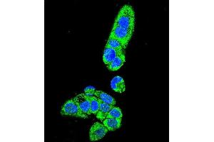 Confocal immunofluorescent analysis of FAH Antibody (N-term) (ABIN655906 and ABIN2845306) with HepG2 cell followed by Alexa Fluor 488-conjugated goat anti-rabbit lgG (green).