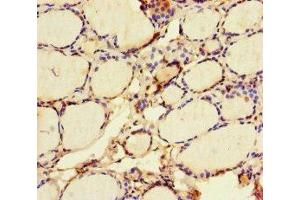 Immunohistochemistry of paraffin-embedded human thyroid tissue using ABIN7172419 at dilution of 1:100 (VGLL4 Antikörper  (AA 43-277))