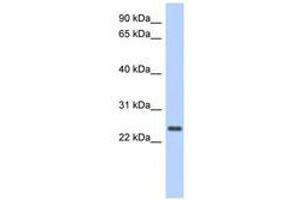 Image no. 1 for anti-Coiled-Coil Domain Containing 70 (CCDC70) (AA 71-120) antibody (ABIN6741256)