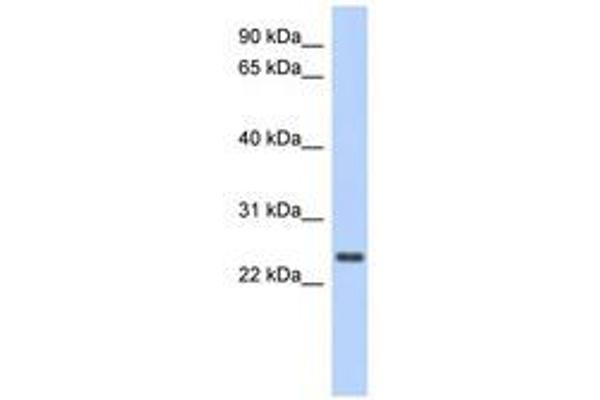 CCDC70 anticorps  (AA 71-120)