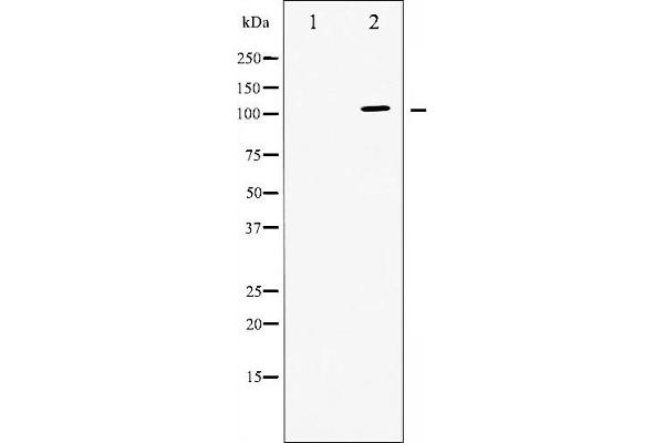 ATP1A1 Antikörper  (N-Term)