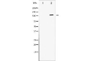 Western blot analysis of ATPase expression in PMA treated 293 whole cell lysates,The lane on the left is treated with the antigen-specific peptide. (ATP1A1 Antikörper  (N-Term))