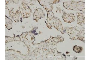 Image no. 1 for anti-Ets Variant 6 (ETV6) (AA 1-453) antibody (ABIN598674) (ETV6 Antikörper  (AA 1-453))