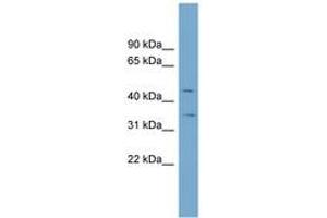 Image no. 1 for anti-Solute Carrier Family 39 (Zinc Transporter), Member 8 (SLC39A8) (AA 107-156) antibody (ABIN6743228) (SLC39A8 Antikörper  (AA 107-156))