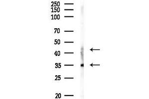 anti-Lysyl Oxidase (LOX) (Internal Region) antibody