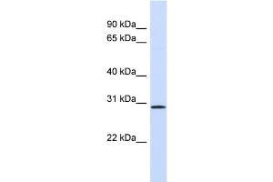 WB Suggested Anti-FGF14 Antibody Titration: 0. (FGF14 Antikörper  (Middle Region))