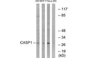 Western blot analysis of extracts from 293/MCF-7/HeLa cells, using Caspase 1 (Ab-376) Antibody. (Caspase 1 Antikörper  (AA 342-391))