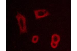 ABIN6267260 staining BT-20 cells by ICC/IF. (EGFR Antikörper  (pTyr1016))