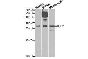 Western Blotting (WB) image for anti-Insulin-Like Growth Factor 2 (IGF2) antibody (ABIN1873163) (IGF2 Antikörper)
