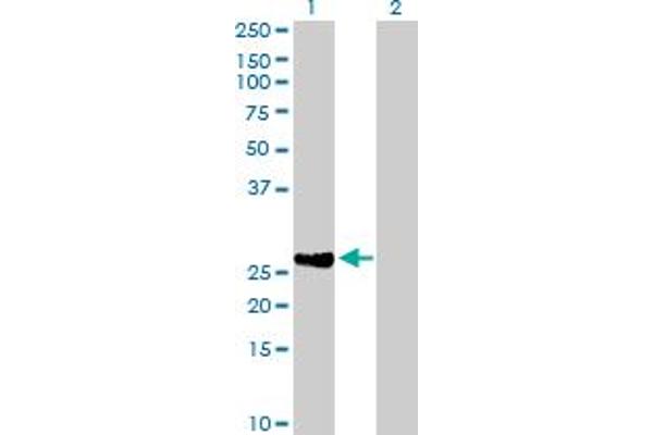 DIRAS2 Antikörper  (AA 1-199)