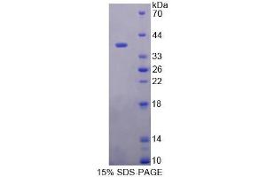 SDS-PAGE analysis of Human PTTG1IP Protein.