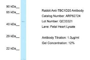 Western Blotting (WB) image for anti-TBC1 Domain Family, Member 20 (TBC1D20) (C-Term) antibody (ABIN2789226) (TBC1D20 Antikörper  (C-Term))