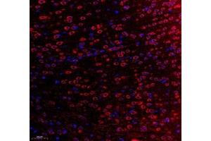 Immunofluorescence (Paraffin-embedded Sections) (IF (p)) image for anti-WD Repeat Domain 81 (WDR81) antibody (ABIN7076221)