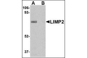 Western blot analysis of LIMP2 in human skeletal muscle tissue lysate with this product at 1 μg/ml in (A) the absence and (B) presence of blocking peptide. (SCARB2 Antikörper  (Center))