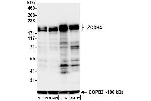 Western Blotting (WB) image for anti-Zinc Finger CCCH-Type Containing 4 (ZC3H4) (AA 1050-1100) antibody (ABIN7795761)