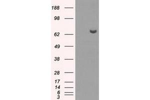 HEK293T cells were transfected with the pCMV6-ENTRY control (Left lane) or pCMV6-ENTRY HDAC10 (Right lane) cDNA for 48 hrs and lysed. (HDAC10 Antikörper)