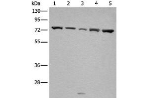 Western blot analysis of Hela and A431 cell Mouse brain tissue HT-29 and Jurkat cell lysates using GARS Polyclonal Antibody at dilution of 1:540 (GARS Antikörper)