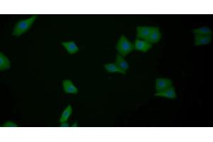 Detection of GAL3 in Human MCF7 cell using Polyclonal Antibody to Galectin 3 (GAL3) (Galectin 3 Antikörper  (AA 1-250))