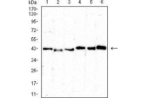Western Blotting (WB) image for anti-CD5 (CD5) (AA 403-495) antibody (ABIN7193687)