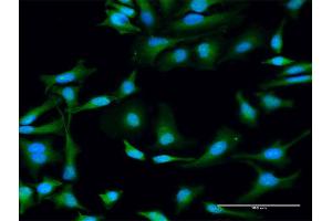 Immunofluorescence (IF) image for anti-Syntaxin 11 (STX11) (AA 1-287) antibody (ABIN522125)