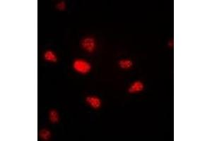 Immunofluorescent analysis of Progesterone Receptor staining in A549 cells.