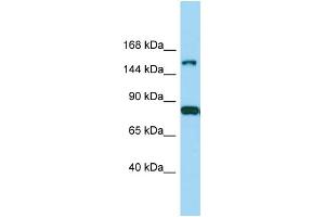 Host: Rabbit Target Name: IQSEC2 Sample Type: MDA-MB-435S Whole Cell lysates Antibody Dilution: 1. (IQSEC2 Antikörper  (Middle Region))