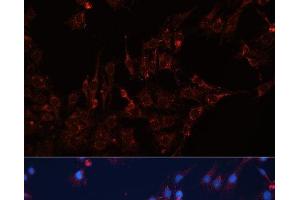 Immunofluorescence analysis of C6 cells using GNAI2 Polyclonal Antibody at dilution of 1:100 (40x lens). (GNAI2 Antikörper)
