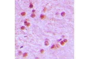 Immunohistochemical analysis of FOXR1 staining in human brain formalin fixed paraffin embedded tissue section. (FOXR1 Antikörper  (C-Term))