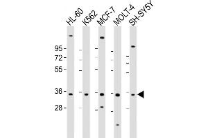 All lanes : Anti-PIGC Antibody (Center) at 1:2000 dilution Lane 1: HL-60 whole cell lysate Lane 2: K562 whole cell lysate Lane 3: MCF-7 whole cell lysate Lane 4: MOLT-4 whole cell lysate Lane 5: SH-SY5Y whole cell lysate Lysates/proteins at 20 μg per lane. (PIGC Antikörper  (AA 81-112))