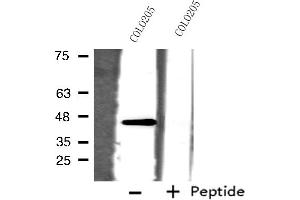 Western blot analysis of extracts from COLO205 cells, using ORCTL-2 antibody. (ORCTL-2/SLC22A18 Antikörper  (C-Term))