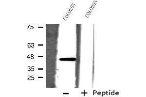 Western blot analysis of extracts from COLO205 cells, using ORCTL-2 antibody.