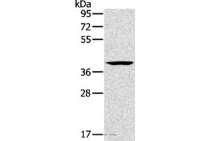 Western blot analysis of Lovo cell, using CAB39 Polyclonal Antibody at dilution of 1:200 (CAB39 Antikörper)
