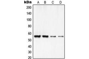 Western blot analysis of RCC2 expression in HeLa (A), A549 (B), MOLT4 (C), NIH3T3 (D) whole cell lysates.