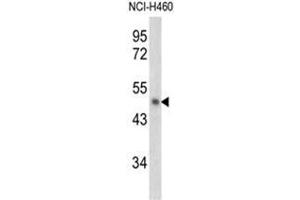 Western blot analysis of PAI2 antibody (Center) in NCI-H460 cell line lysates (35ug/lane). (SERPINB2 Antikörper  (Middle Region))