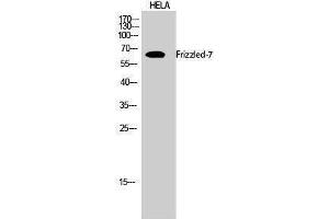 Western Blotting (WB) image for anti-Frizzled Family Receptor 7 (FZD7) (N-Term) antibody (ABIN3184691) (FZD7 Antikörper  (N-Term))