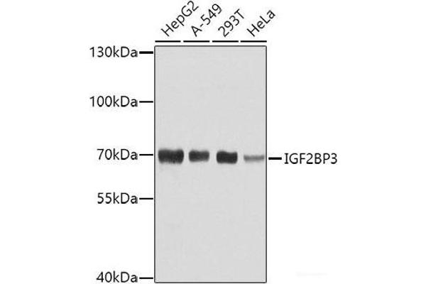 IGF2BP3 anticorps