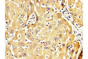 IHC image of ABIN7167891 diluted at 1:300 and staining in paraffin-embedded human liver tissue performed on a Leica BondTM system. (RECK Antikörper  (AA 23-212))