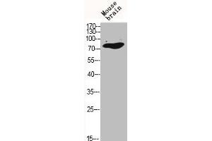 Western Blot analysis of MOUSE-BRAIN cells using C-TAK1 Polyclonal Antibody (MARK3 Antikörper  (N-Term))