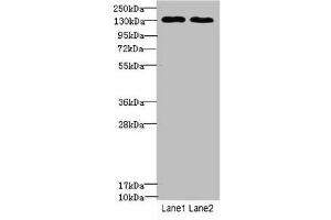 Western blot All lanes: TPP2antibody at 3. (Tpp2 Antikörper  (AA 1-300))