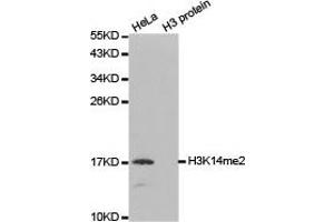 Western blot analysis of extracts of HeLa and H3 protein, using H3K14me2 antibody. (Histone 3 Antikörper  (H3K14me2))