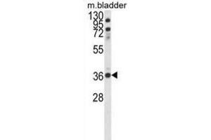 Western Blotting (WB) image for anti-Coiled-Coil Domain Containing 3 (CCDC3) antibody (ABIN3003893) (CCDC3 Antikörper)