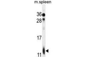 Western Blotting (WB) image for anti-Ribosomal Protein L39 (RPL39) antibody (ABIN2996042) (RPL39 Antikörper)