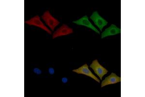 Cytochrome P450 4F12 Mouse Monoclonal Antibody staining Hela cells by IF/ICC.