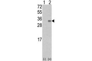 Western blot analysis of VEGFB antibody and 293 cell lysate (2 ug/lane) either nontransfected (Lane 1) or transiently transfected with the VEGF2/VEGFB gene (2). (VEGFB (VEGF2) (AA 110-139) Antikörper)