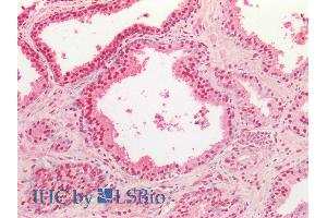 ABIN334503 (5µg/ml) staining of paraffin embedded Human Prostate. (TARDBP Antikörper  (Internal Region))